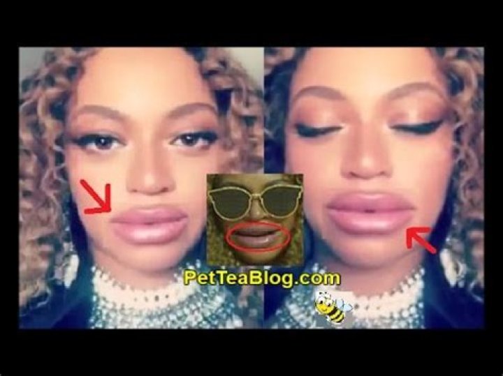 Beyoncé's Publicist Shuts Down Lip Injection Rumours