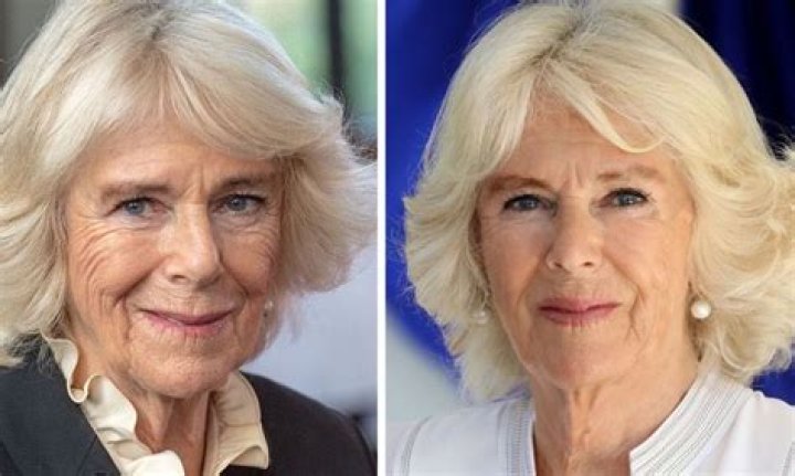Camilla Parker-Bowles Plastic Surgery: Prince Charles’ Wife Underwent Tummy Tuck & Liposuction - World Still Didn’t Love Her!