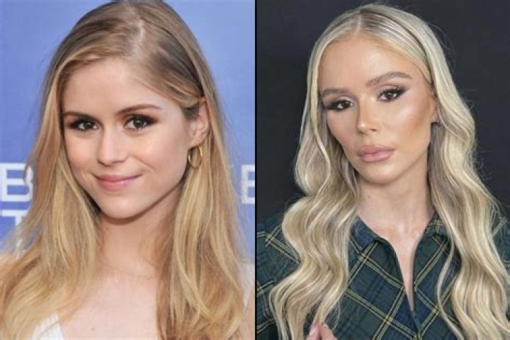 Chloe Bailey Weight Gain Viral On Tiktok: Plastic Surgery Before And After