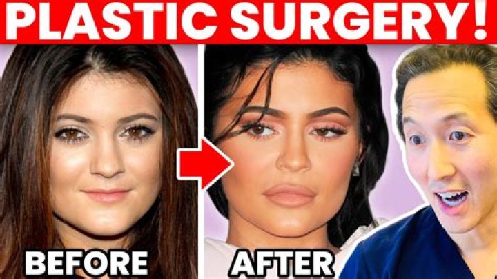 Did Mimi Keene Undergo Plastic Surgery? Before After Photos And Rumor