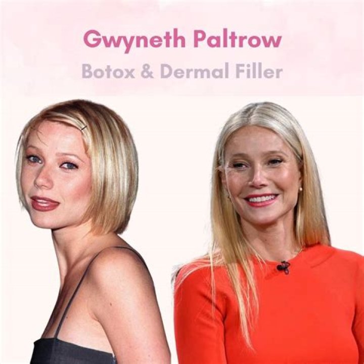 Gwyneth Paltrow’s Plastic Surgery: Gets Boob Job And Botox Years After Her Nose Job