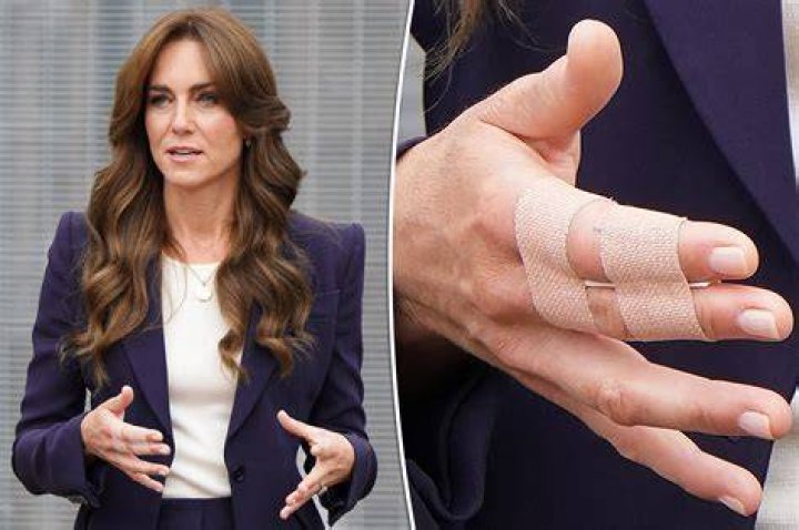 Kate Middleton Anorexia Rumors – The Duchess of Cambridge is NOT Battling an Eating Disorder