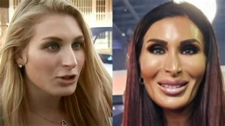 Laura Loomer’s Plastic Surgery: Is She Addicted To Cosmetic Surgery? Look at the Before and After Pictures!