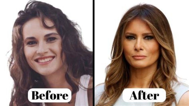 Laura Marano Plastic Surgery: Did She Get A Nose Job? Before And After Photos Revealed On Her Instagram