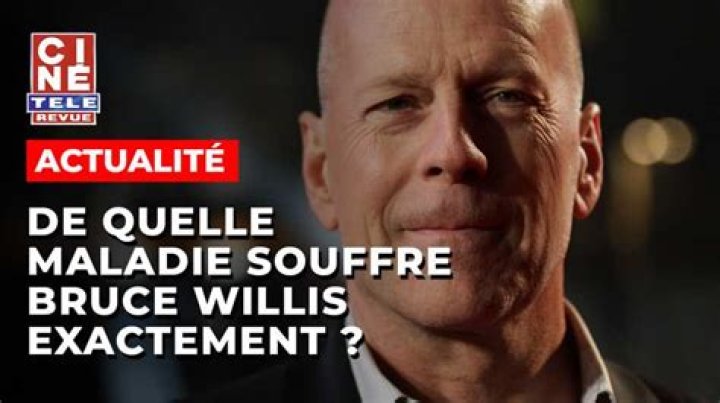 Quelle Est La Maladie De Bruce Willis