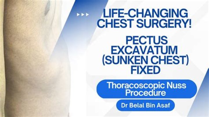 What Happened To Steven Crowder? His Health And Pectus Surgery Update